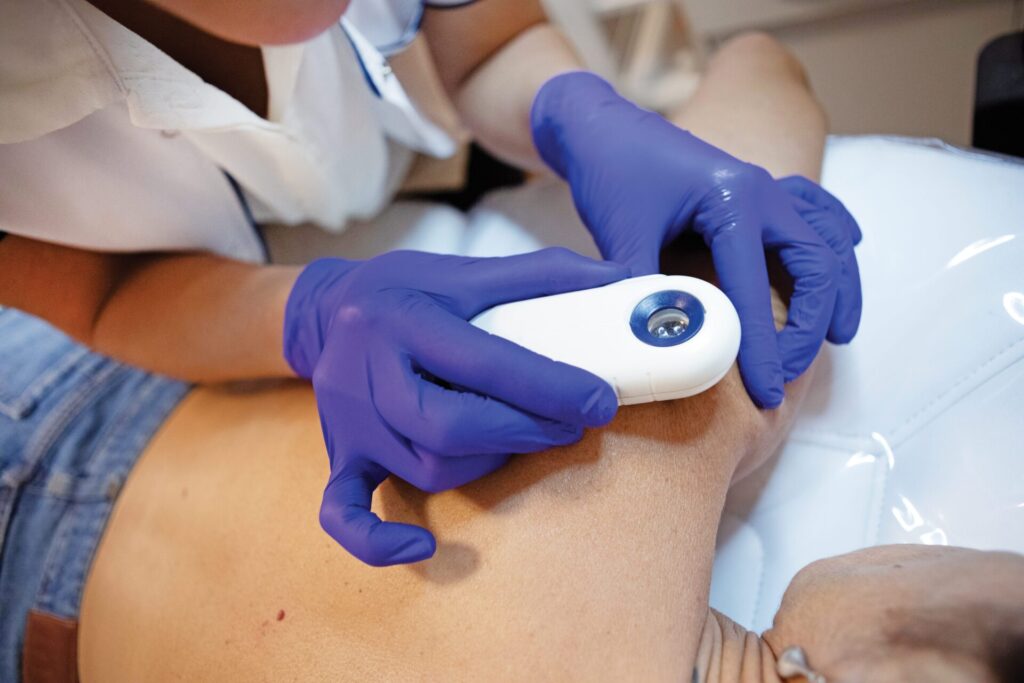 dermatologist examining child's moles magnifying glass
